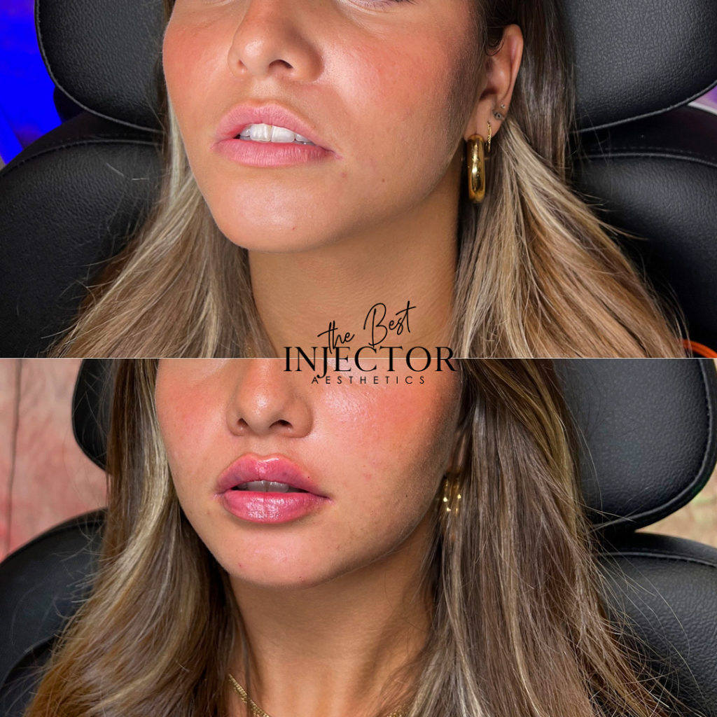 Best Injector – West Atlantic Ave Studio 33 Delray Beach, FL at The Best Injector