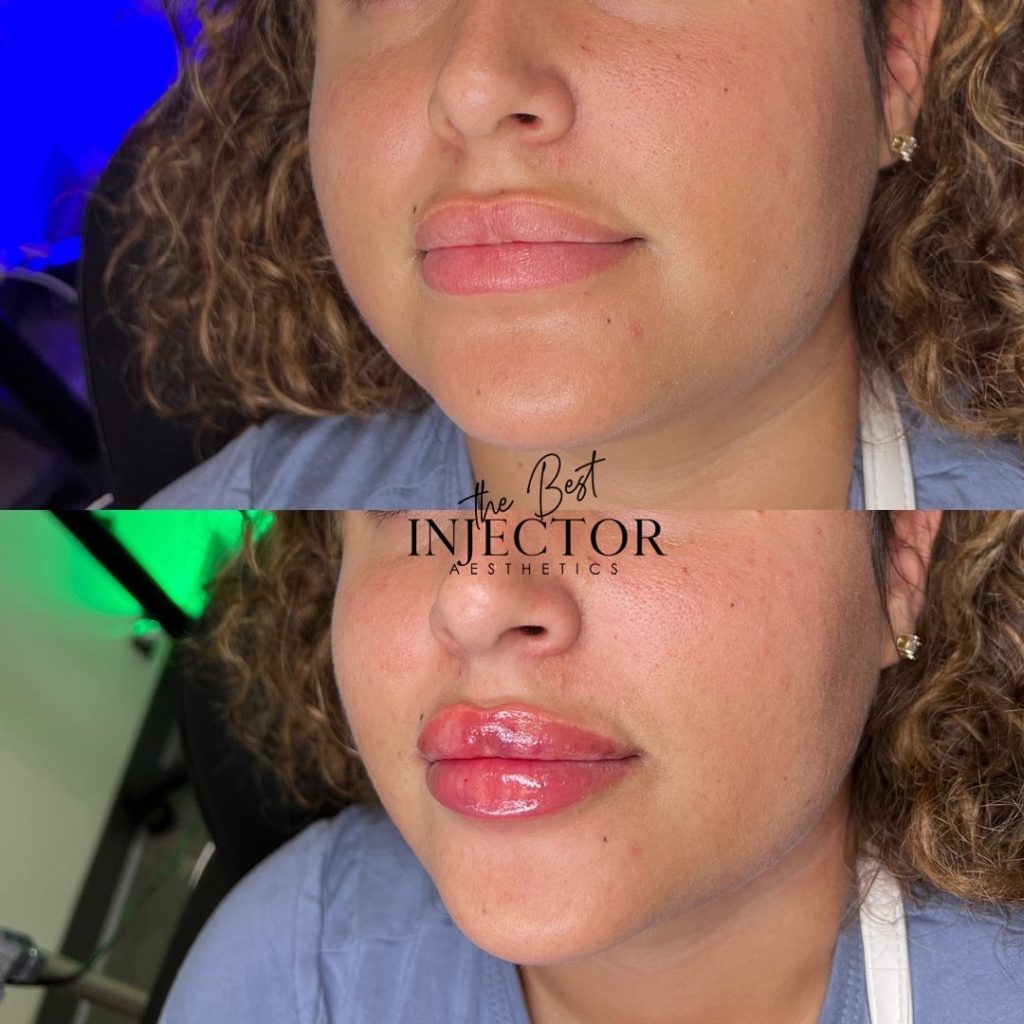 Best Injector – West Atlantic Ave Studio 33 Delray Beach, FL at The Best Injector