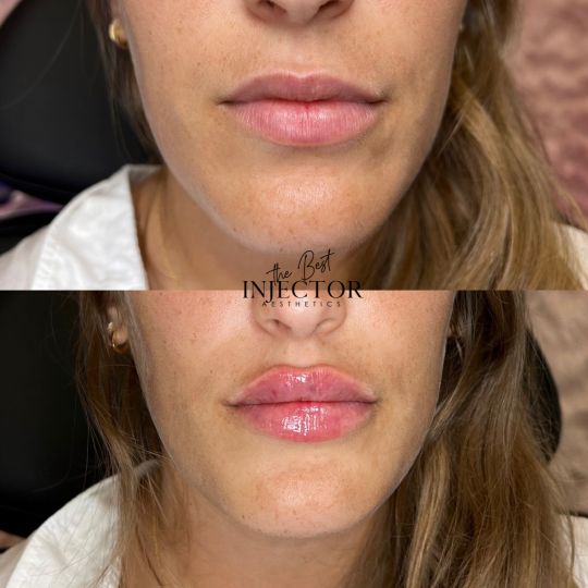 Best Injector – West Atlantic Ave Studio 33 Delray Beach, FL at The Best Injector