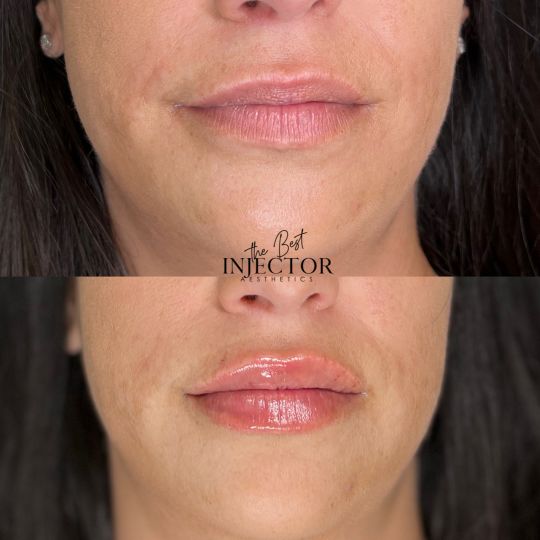 Best Injector – West Atlantic Ave Studio 33 Delray Beach, FL at The Best Injector