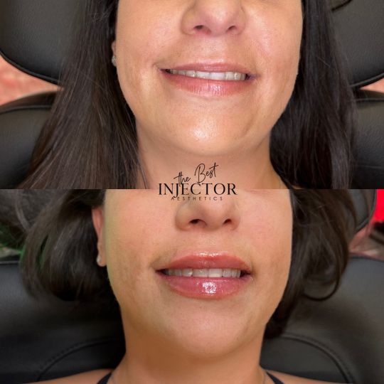 Best Injector – West Atlantic Ave Studio 33 Delray Beach, FL at The Best Injector