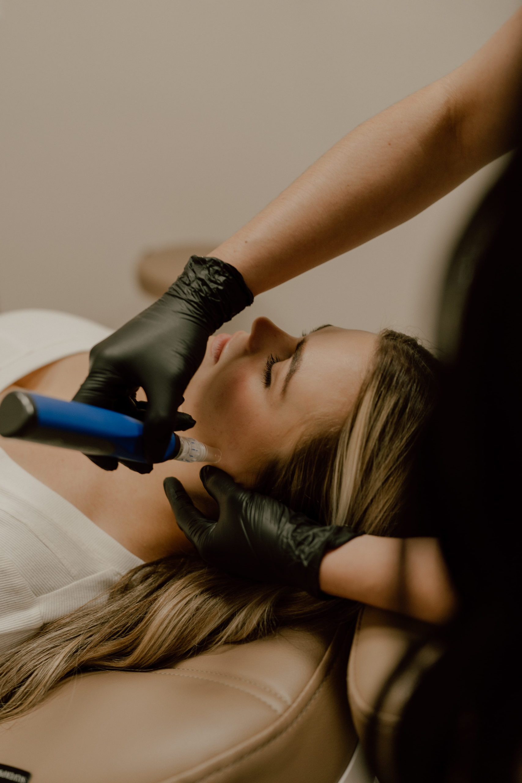skinpen at The Best Injector