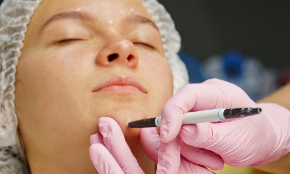 What is Kybella, and Is It Safe at The Best Injector